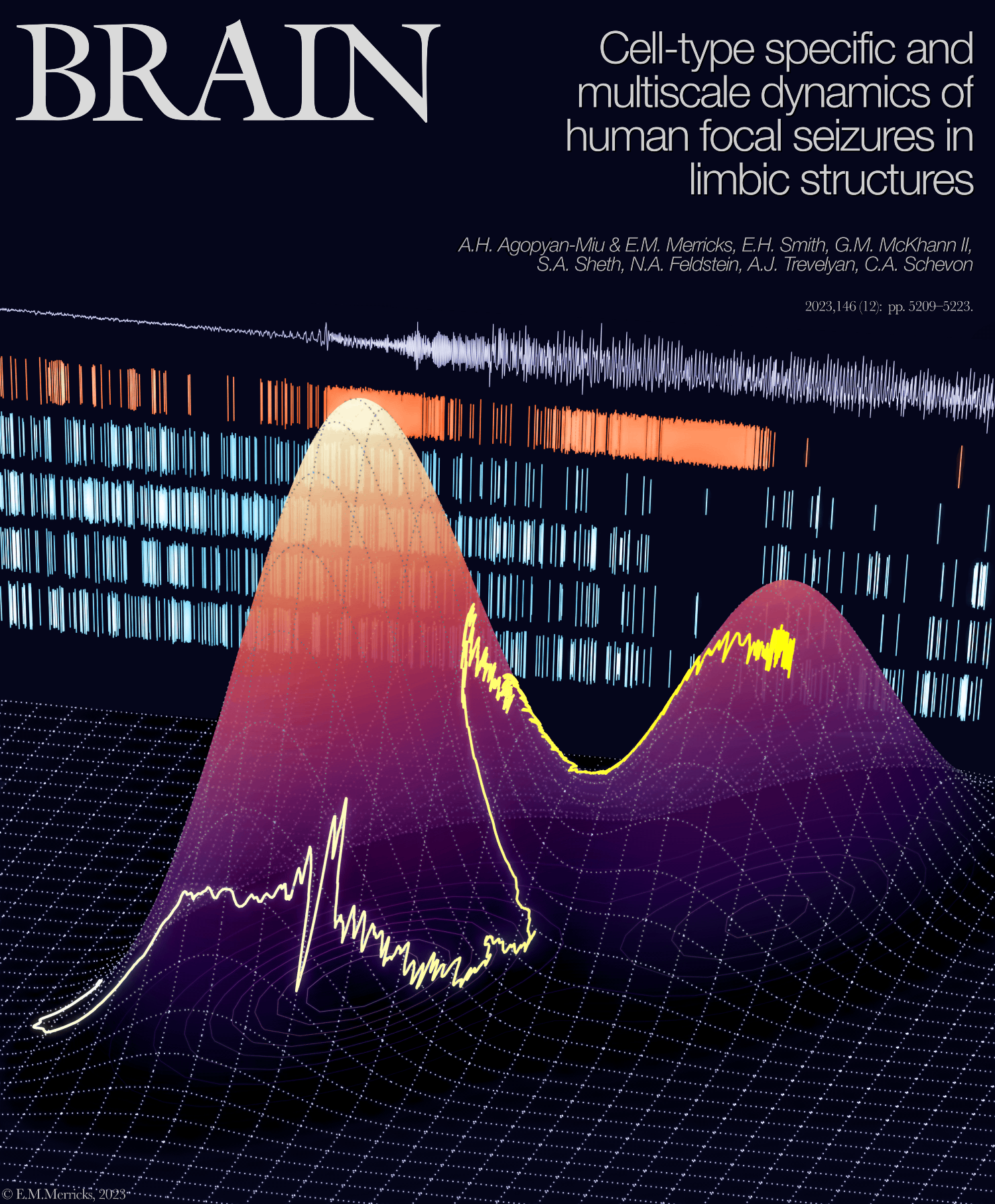 Cover art for Agopyan-Miu et al 2023 paper in Brain